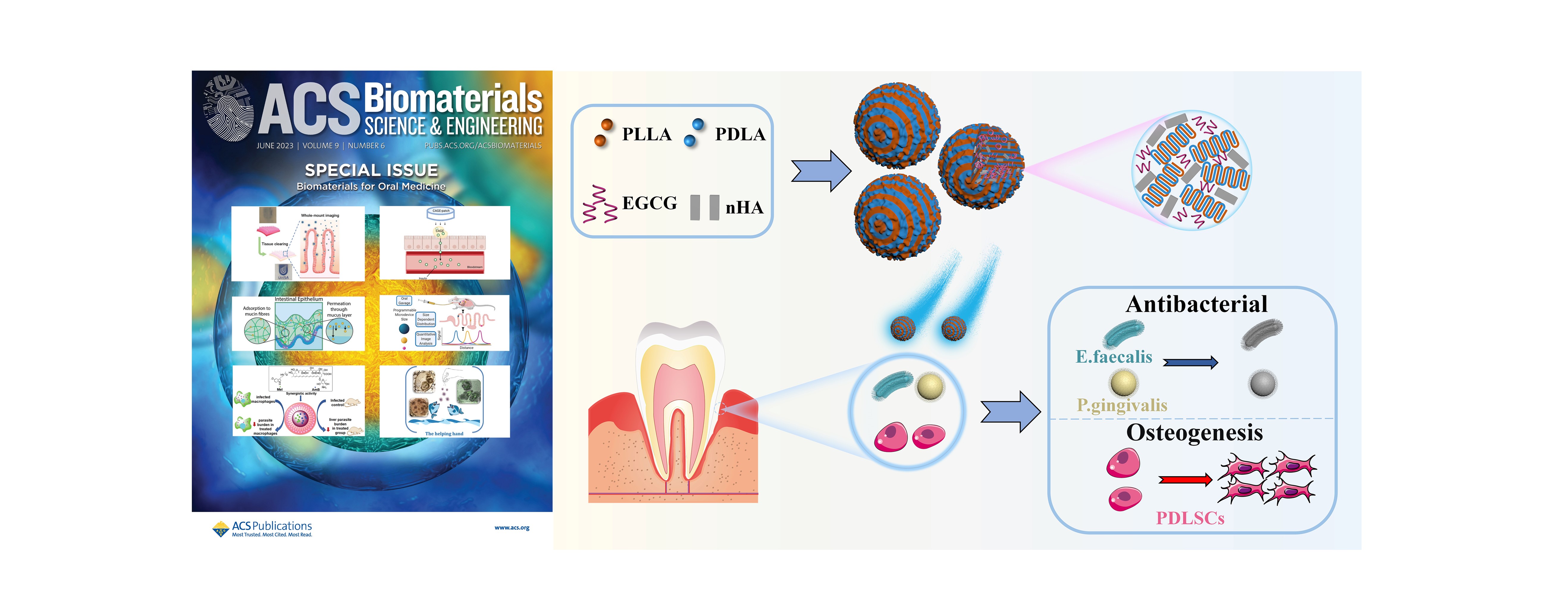 用于牙周炎修复的聚乳酸复合微球论文发表于ACS BSE期刊 