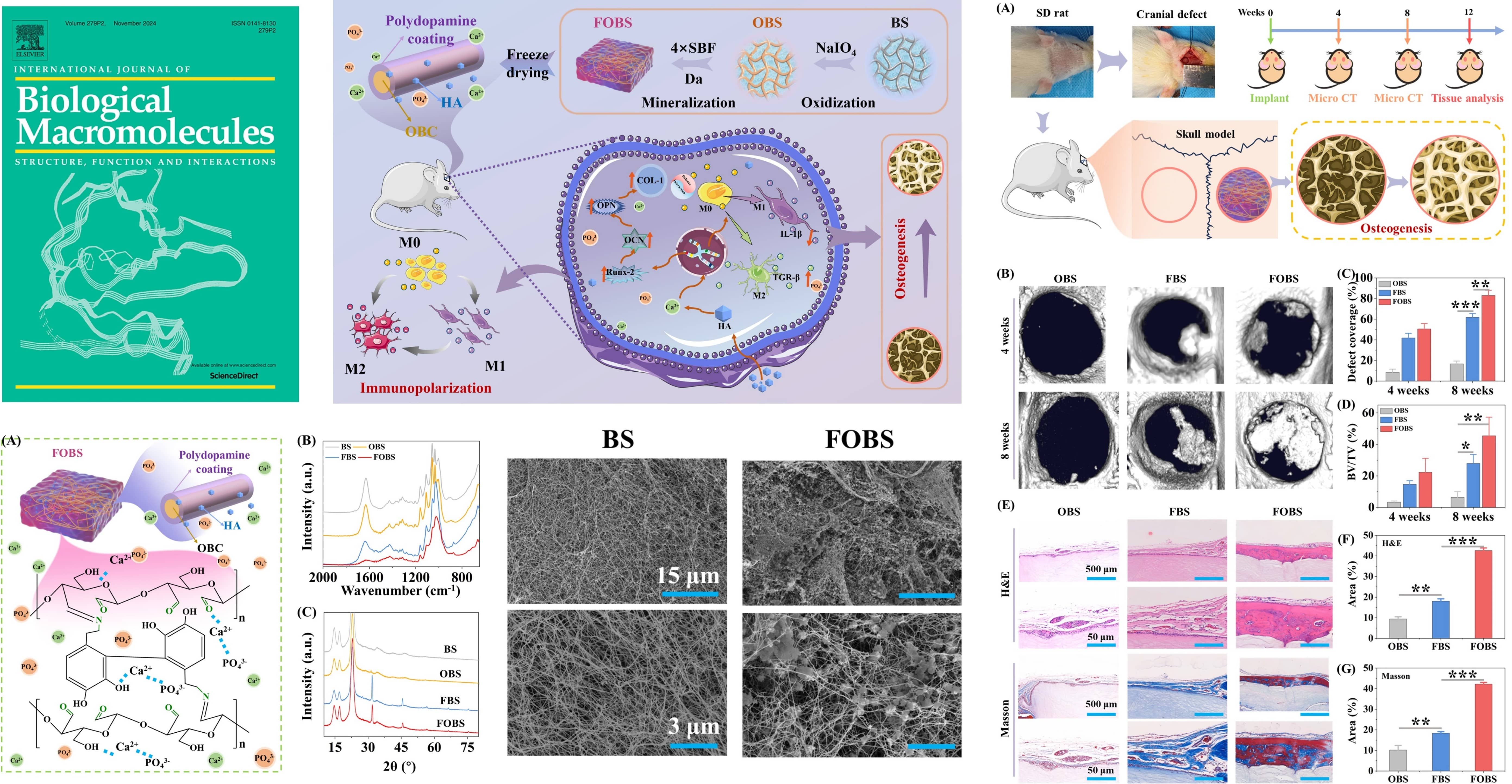 An Immunomodulatory and Osteogenic Bacterial Cellulose Scaffold for Bone Regeneration via Regulating the Immune Microenvironment